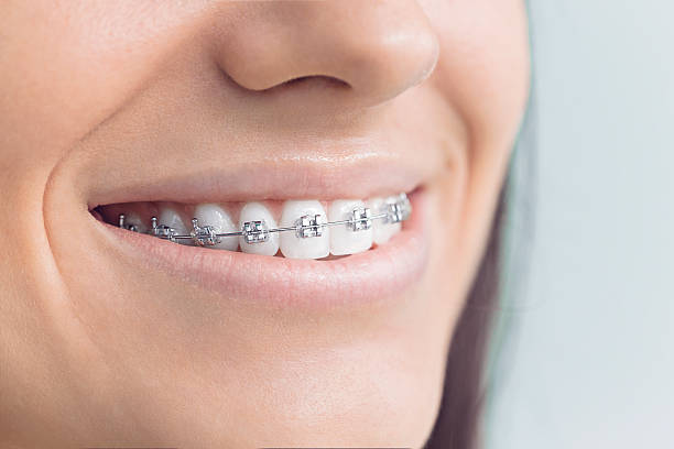 Best Veneers and Lumineers  in Lavon, TX
